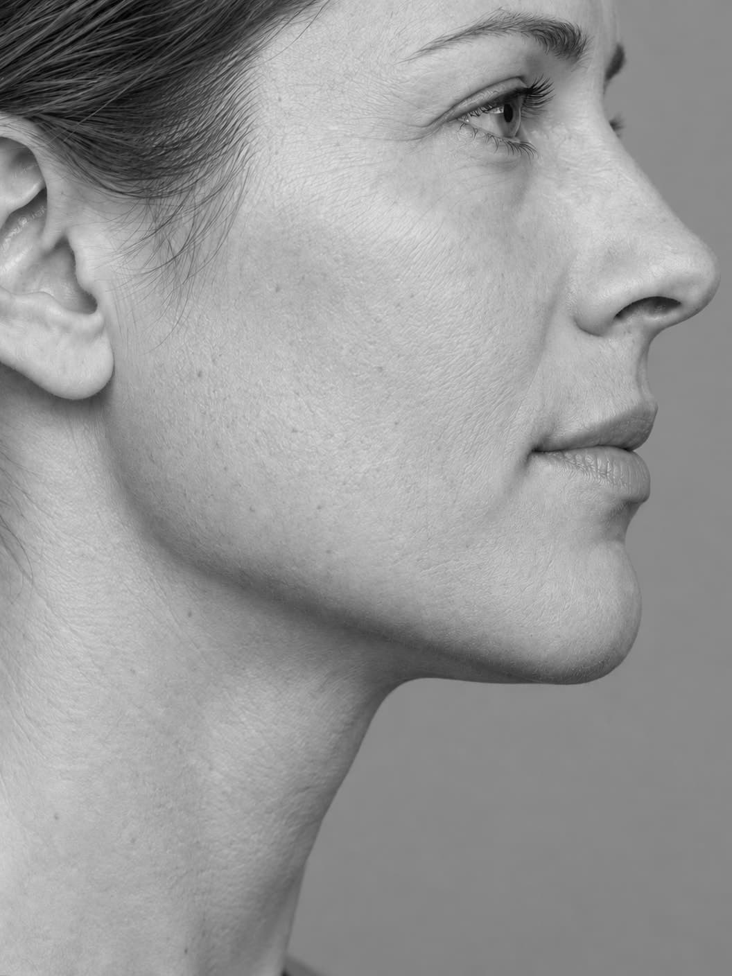 Black-and-white close side profile of a woman showing her lips, chin and jawline